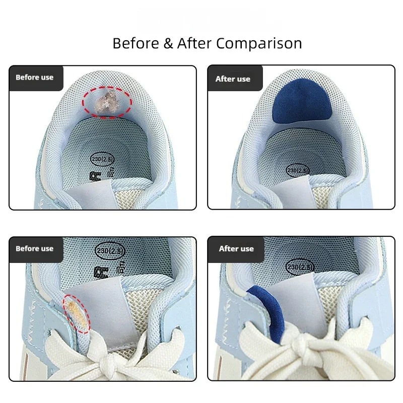 6 Pezzi Patch per Riparazione  - Life Sneaker Care recensione e prezzo